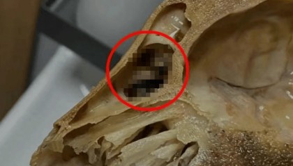 吃完发现全是蛆,恶心呕吐一整夜!上海法院判了:赔1000元