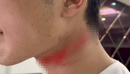 男主播骑车载女友回家被路边掉落网线勒伤脖子,索赔3万陷僵局 律师解读该谁赔