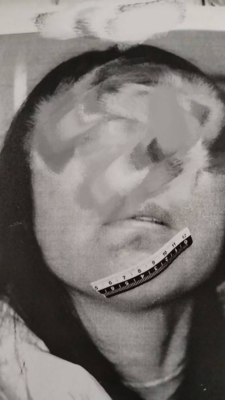 男粉丝咬伤女主播后写条子:赔“十万元”还是赔“十5元”?